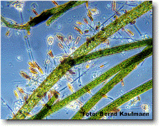 Algen unter dem Mikroskop